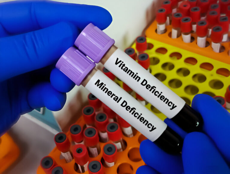 What Vitamin Deficiency Could Be Causing Your Hair Loss? Identifying Key Nutrients for Healthy Hair